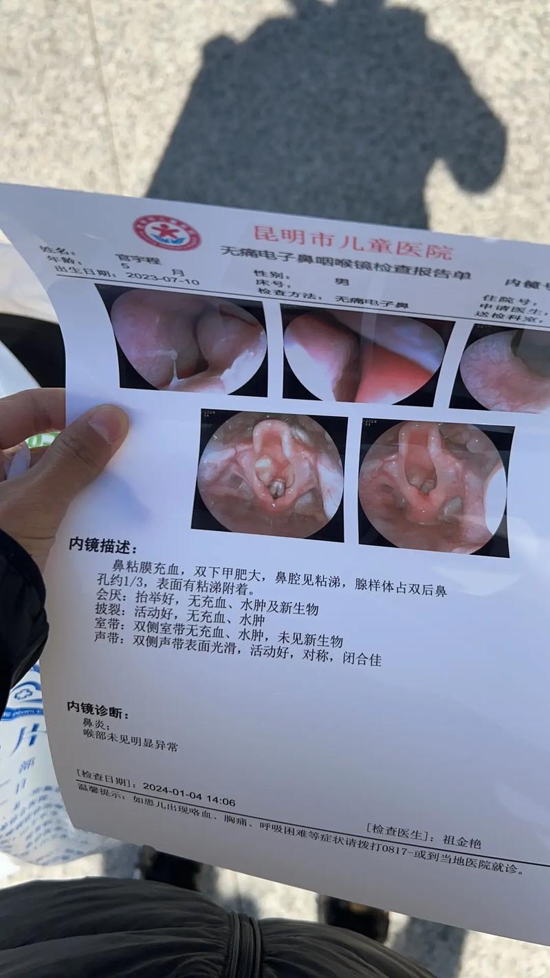 小宝宝鼻炎