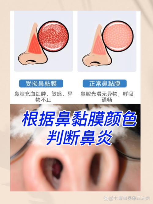 鼻腔黏膜刺激