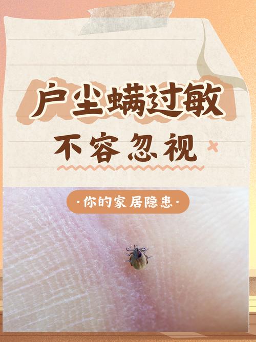 户尘螨