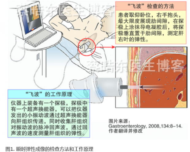 飞波技术