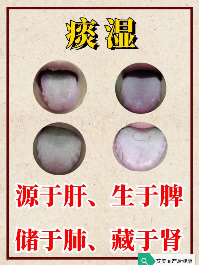 痰湿