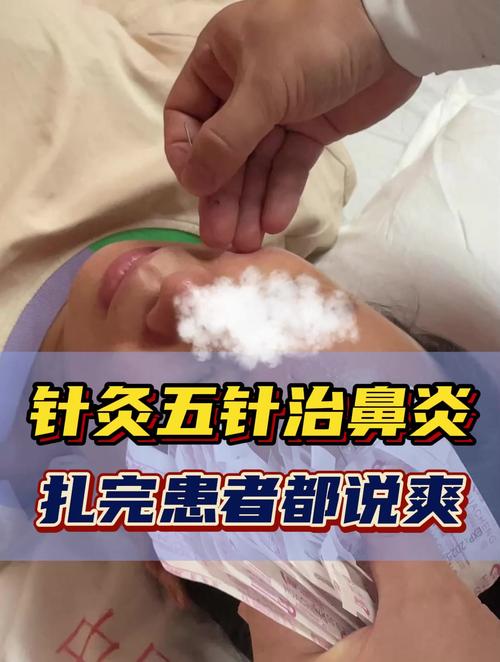 鼻炎咳嗽能用打针治好吗？