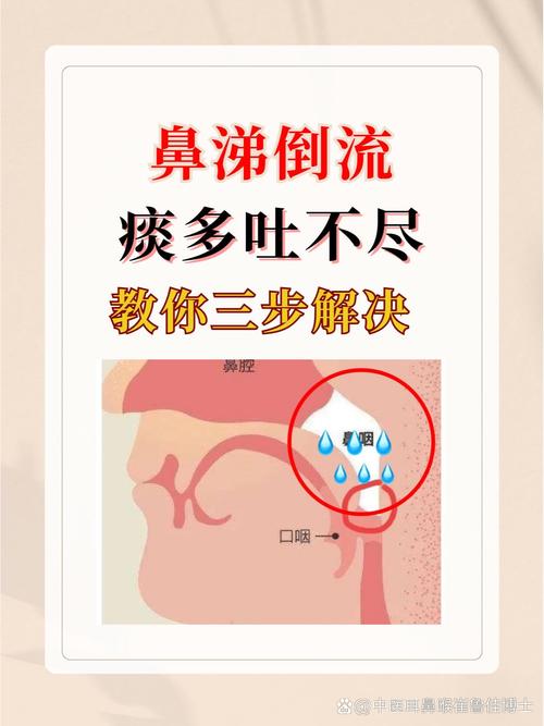 过敏性鼻炎引发的痰多和恶心？