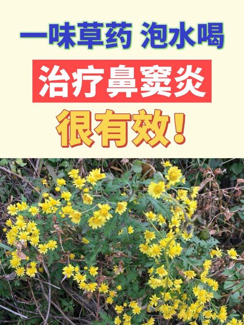 中草药治疗鼻炎的选择与应用