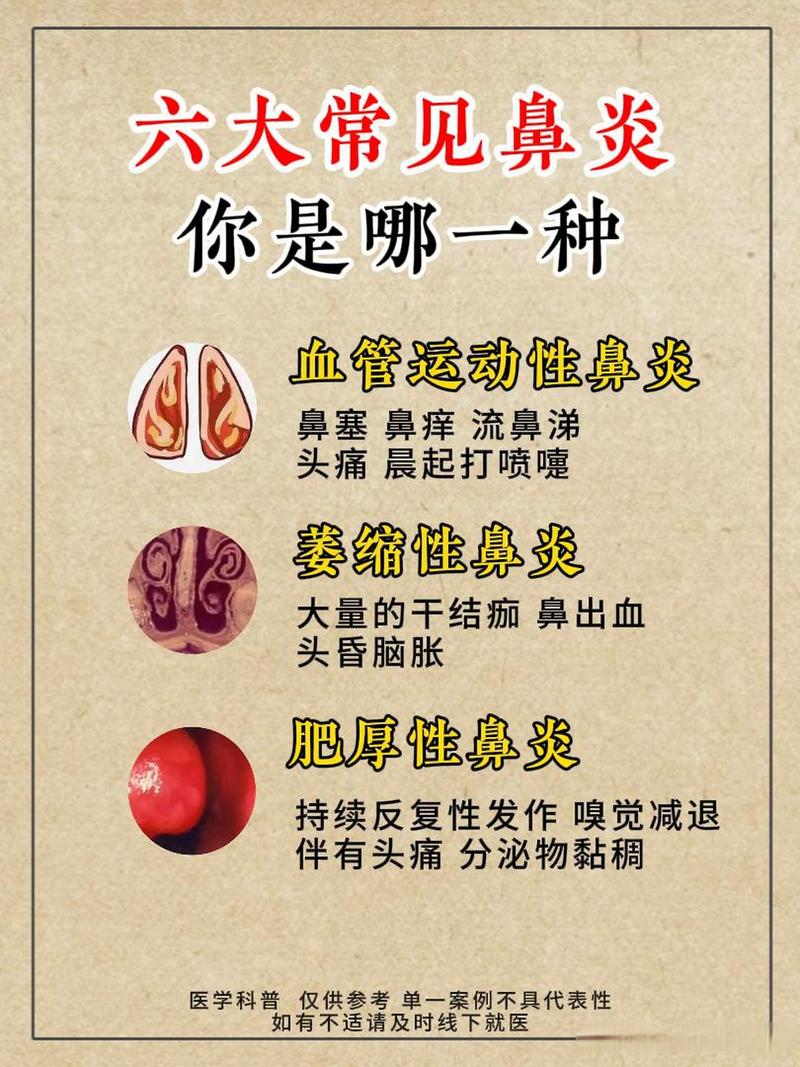 现代发展
描述: 本文从古至今追溯了鼻炎熏蒸疗法的历史，讲述其在各时期的发展，包括古代的萌芽繁荣、近现代的传承创新及当代的普及多元，还对其未来进行展望，展现这一传统疗法的魅力与价值 。