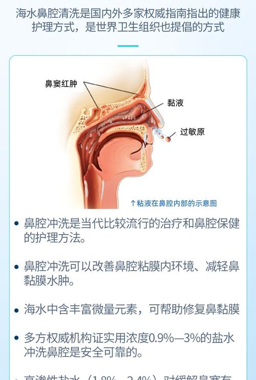 呼吸道感染预防
描述: 本文详细介绍了盐水清洗鼻腔的原理、清洗后鼻腔的变化，如清洁、黏膜改善、湿度调节等，还观察了其在缓解鼻炎症状和预防呼吸道感染方面的疗效，并讲解了正确洗鼻方法，助您了解这一鼻腔保健方式。